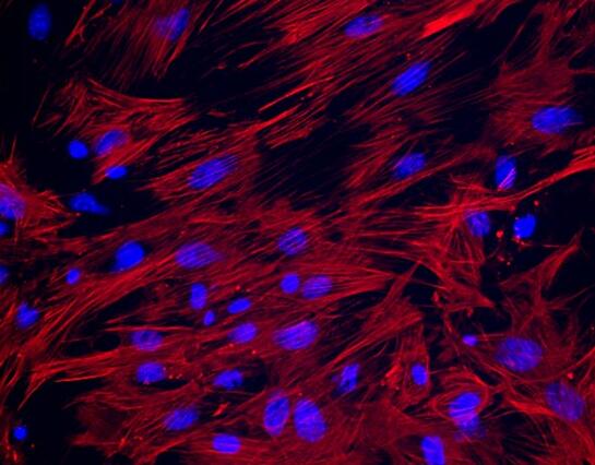 小鼠子宫平滑肌细胞