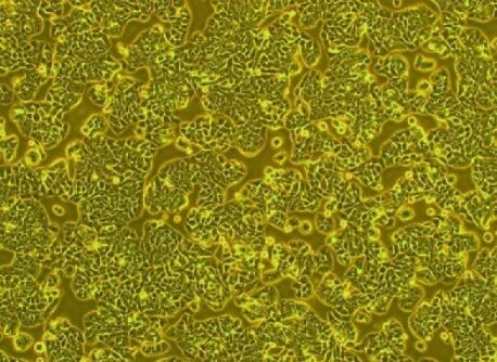 小鼠脑动脉血管平滑肌细胞