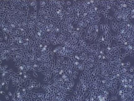 小鼠脑静脉血管内皮细胞