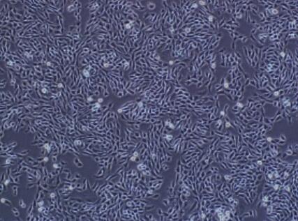 小鼠脑静脉血管平滑肌细胞