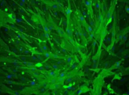 小鼠小梁网细胞