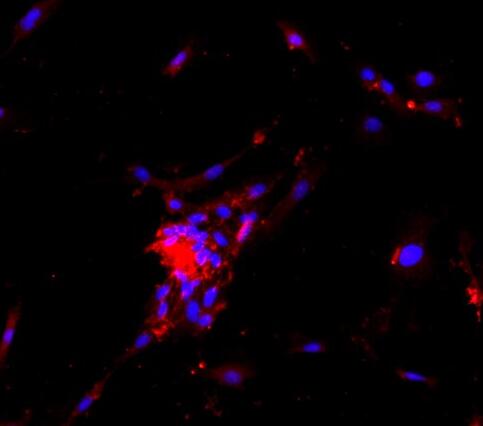 小鼠心脏微血管内皮细胞