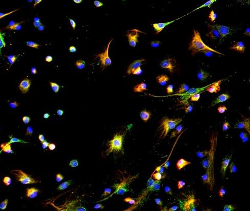 小鼠腹膜间皮细胞