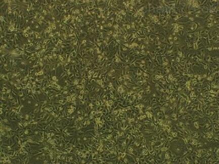 小鼠前列腺平滑肌细胞