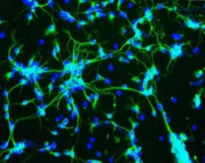 小鼠小肠Cajal间质细胞