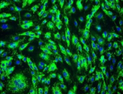 小鼠卵泡膜细胞