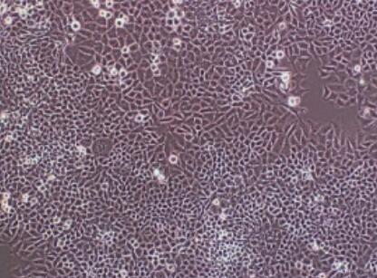 小鼠肠动脉平滑肌细胞