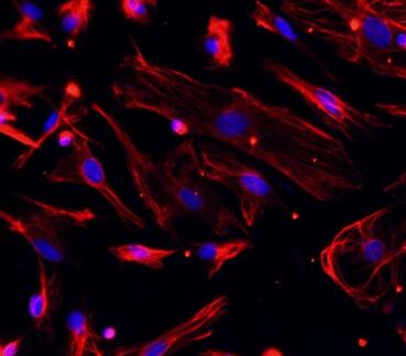 大鼠肺成纤维细胞