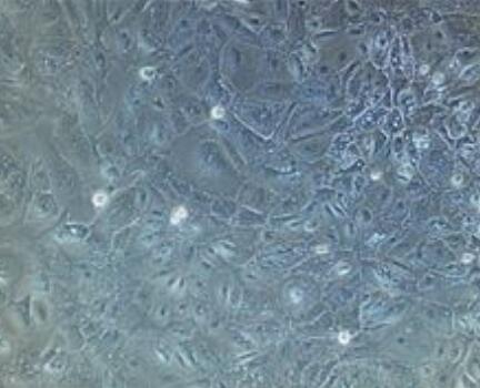 大鼠支气管成纤维细胞
