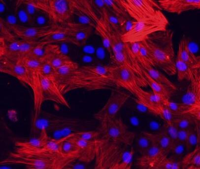 大鼠肺大动脉平滑肌细胞