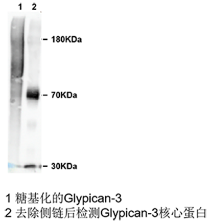 glypican 3小鼠单抗；Anti-Glypican 3 antibody; GPC3 
