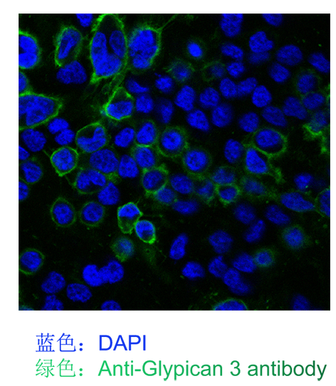 glypican 3小鼠单抗；Anti-Glypican 3 antibody; GPC3 