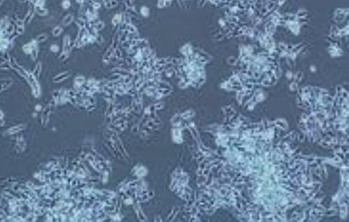 大鼠脑动脉血管内皮细胞