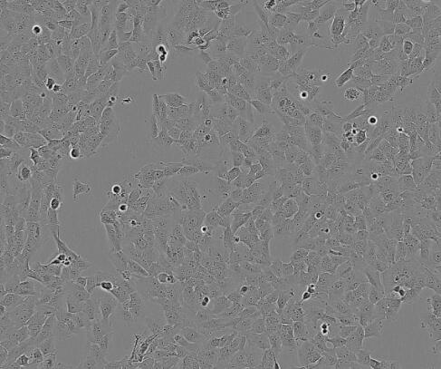 大鼠脑成纤维细胞