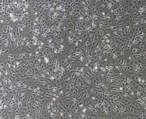 大鼠终板软骨细胞