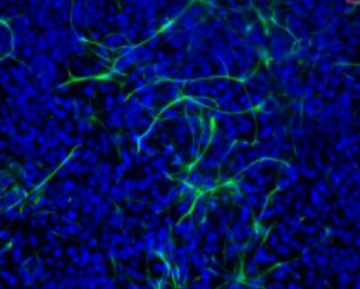 大鼠肝外胆管上皮细胞