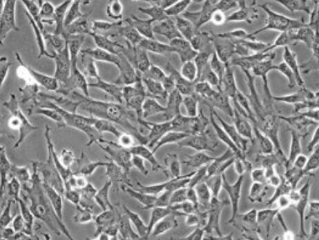 大鼠骨内膜间充质干细胞