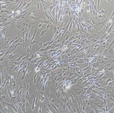 大鼠脉络膜微血管内皮细胞