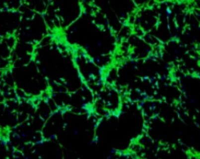 大鼠子宫内膜基质细胞