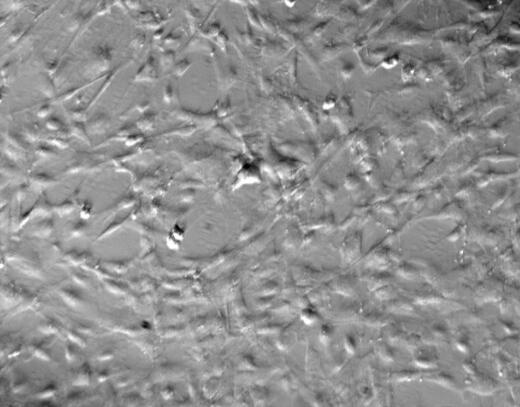 大鼠脑膜成纤维细胞