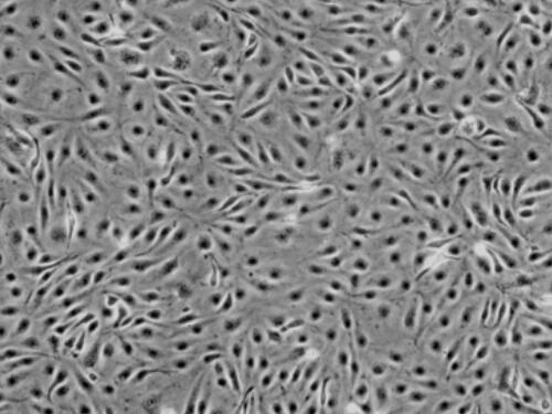 兔脑静脉血管内皮细胞
