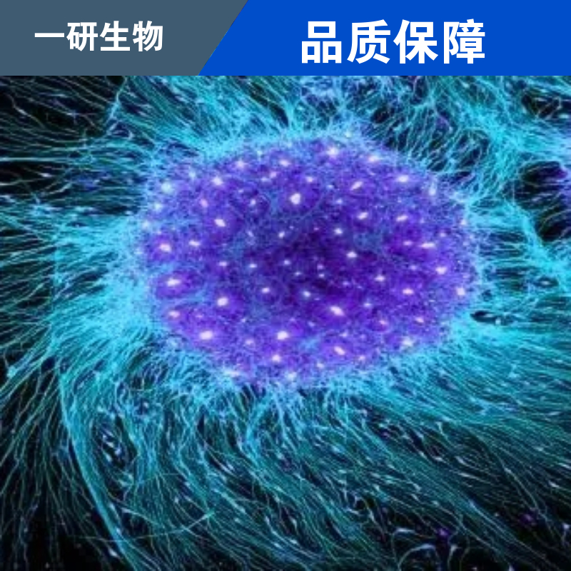 人脑星形胶质母细胞瘤