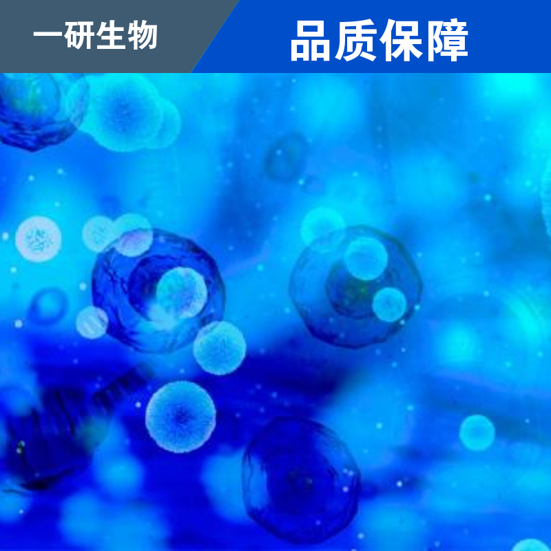 人急性淋巴白血病细胞