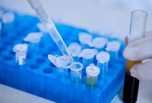 CA9 Antibody生产供应商艾普蒂生物