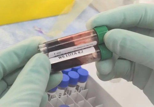 PFKP Antibody 生产供应商艾普蒂生物