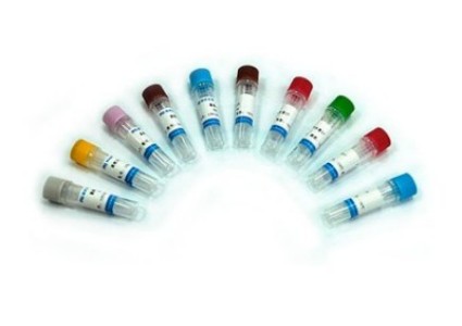 人 PDCL3 蛋白 生产供应商 艾普蒂生物