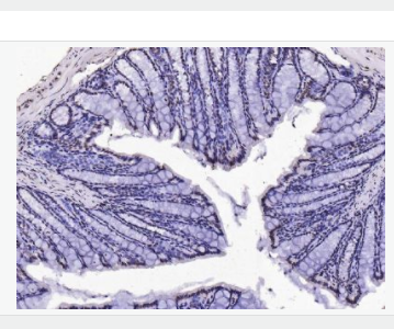 Anti-BubR1-有丝分裂检验点蛋白BubR1抗体