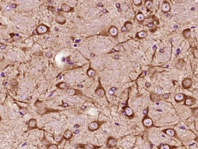 Anti-ALOX5 antibody-5-脂氧合酶抗体