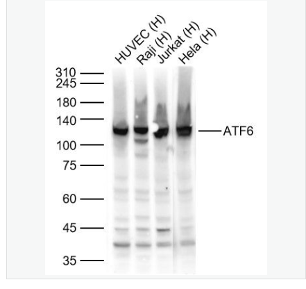 ATF6 antibody-活化转录因子6抗体