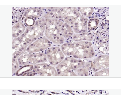 Anti-phospho-AMPK alpha-1-磷酸化腺苷单磷酸活化蛋白激酶α1抗体