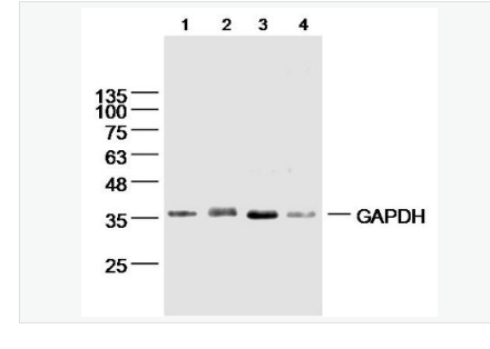 Anti-GAPDH-Loading-3-磷酸甘油醛脱氢酶（内参）单克隆抗体