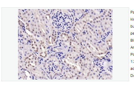 Anti-phospho-c-Jun-磷酸化原癌基因c-Jun抗体