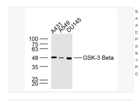 Anti-GSK-3 Beta antibody-糖原合酶激酶-3β单克隆抗体