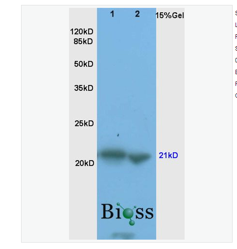 Anti-Bax antibody-Bax抗体