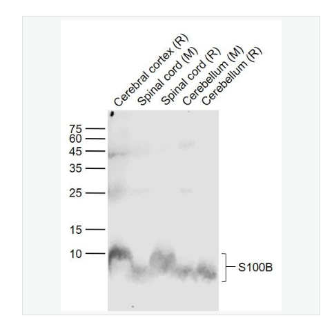 Anti-S100B antibody -S100B蛋白单克隆抗体
