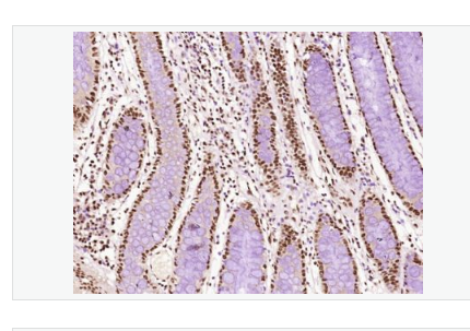 Anti-MYBL2 antibody-转录因子MYB相关蛋白B抗体