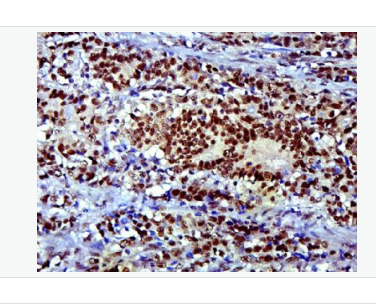 Anti-SOX9 antibody -转录因子SOX9蛋白抗体