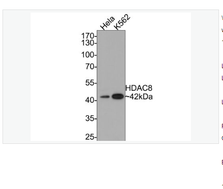 Anti-HDAC8 antibody-组蛋白去乙酰化酶8重组兔单克隆抗体