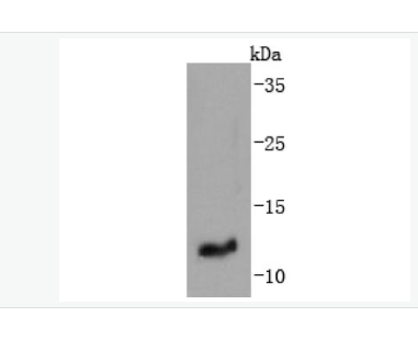 Anti-IGF2 antibody-胰岛素样生长因子-II重组兔单克隆抗体