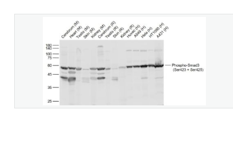 Anti-Phospho-Smad3-磷酸化细胞信号转导分子SMAD3抗体
