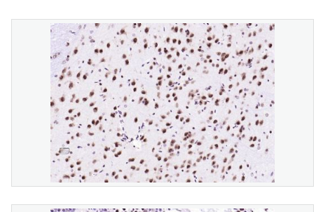Anti-Ubiquitin antibody -泛素蛋白单克隆抗体
