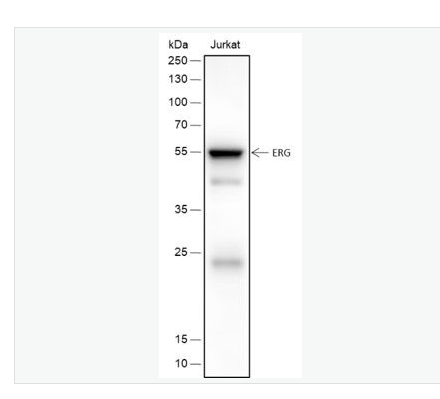 Anti-ERG antibody- 癌基因ERG重组兔单克隆抗体