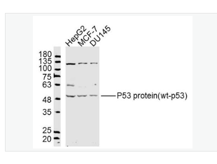 Anti-P53 protein- 肿瘤抑制基因P53蛋白/野生型P53抗体