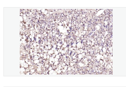 Anti-PPM1D antib- 原癌基因WIP1抗体