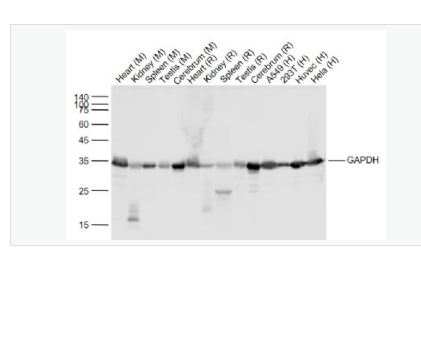 Anti-GAPDH- 3-磷酸甘油醛脱氢酶（内参）重组兔单克隆抗体