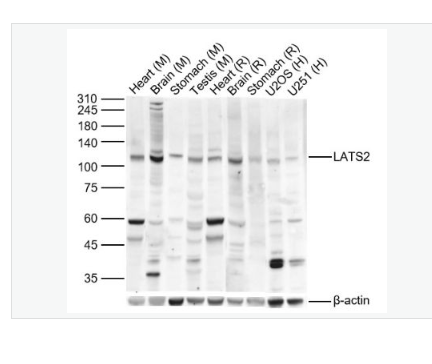 Anti-LATS2 antibody- 肿瘤抑制基因LATS2抗体